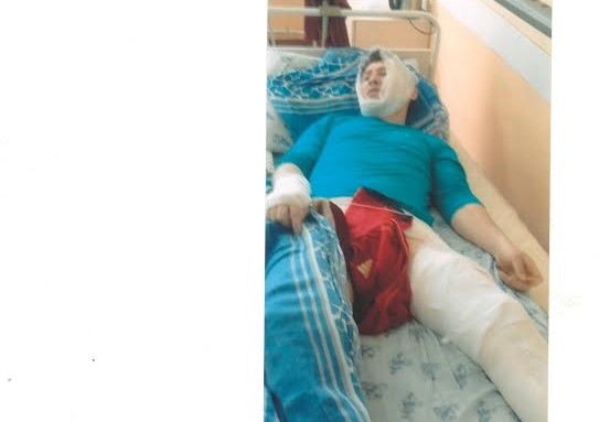 Хусан Жамалов в больнице Дустликского района Джизакской области после пыток в милиции...