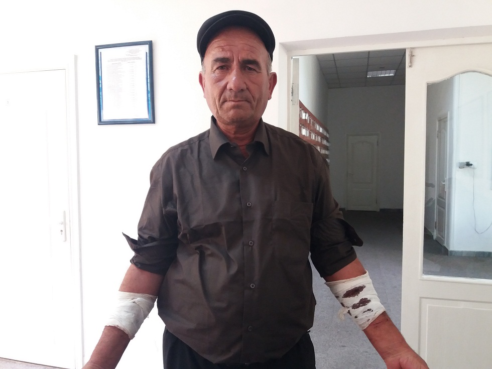 Фамил Абдурахманов в Ташкенте показывает порезанные руки; фото: Татьяна Довлатова