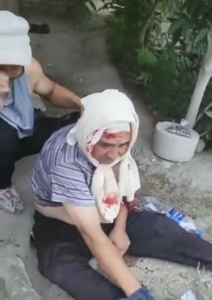 Один из раненых на улицах Нукуса; фото: Соцсеть