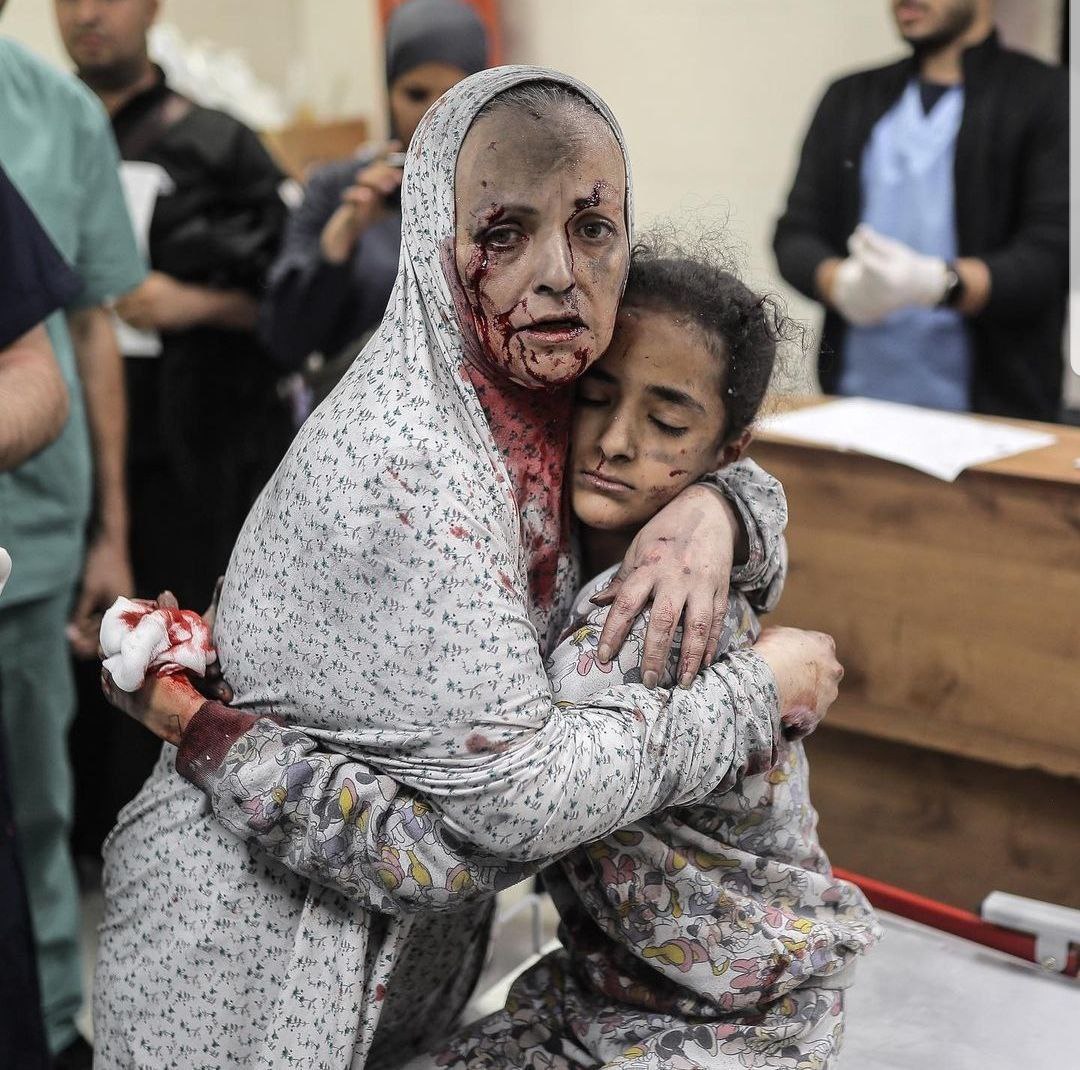 Жертвы геноцида в Палестине; фото: "Аль-Джазира"
